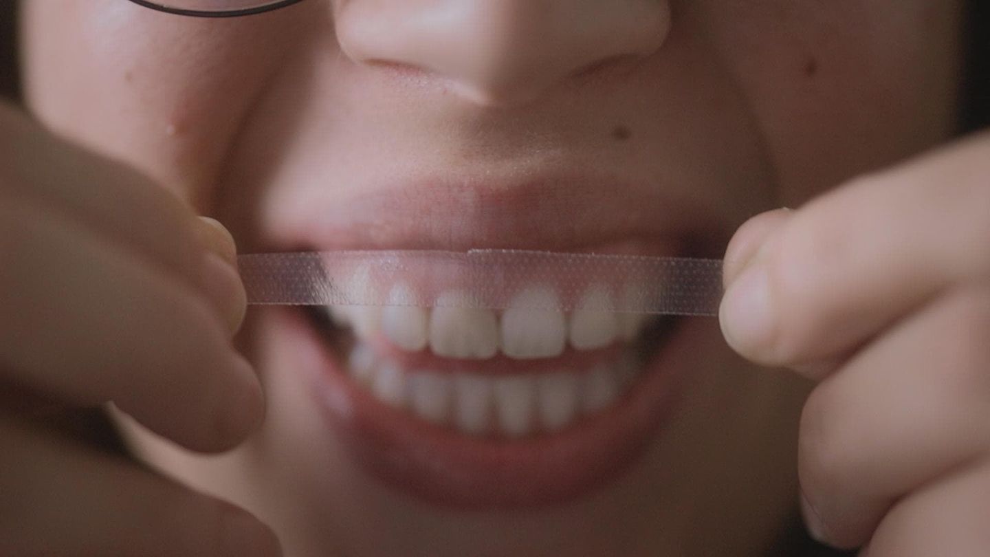 Des dents blanches... au rire jaune !