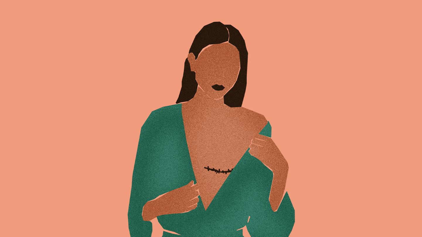 Mes seins ne me tueront pas