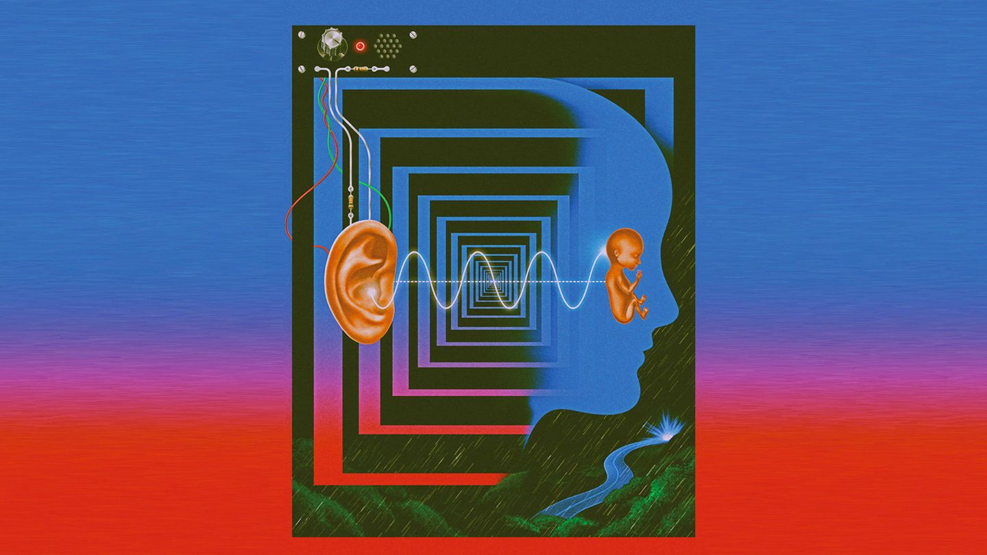 Ultrasound