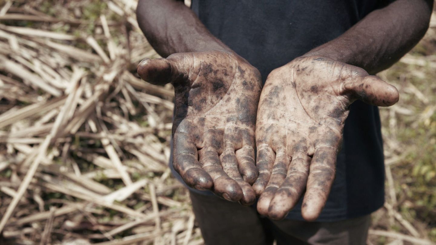 Le sucre, pour la douceur et pour le pire