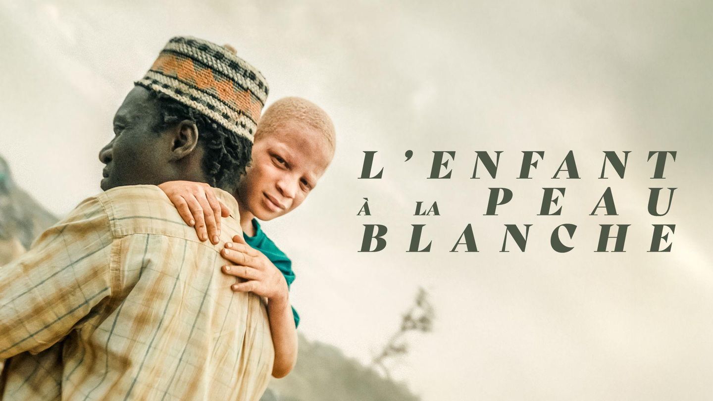 L'enfant à la peau blanche
