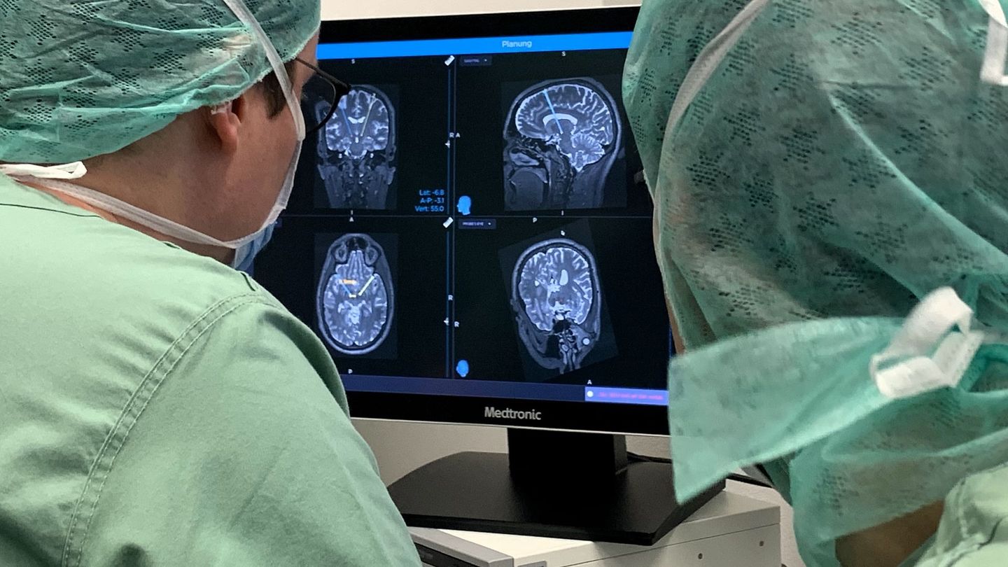 Soigner Parkinson, l'épilepsie, la dépression : La stimulation cérébrale, un nouvel espoir