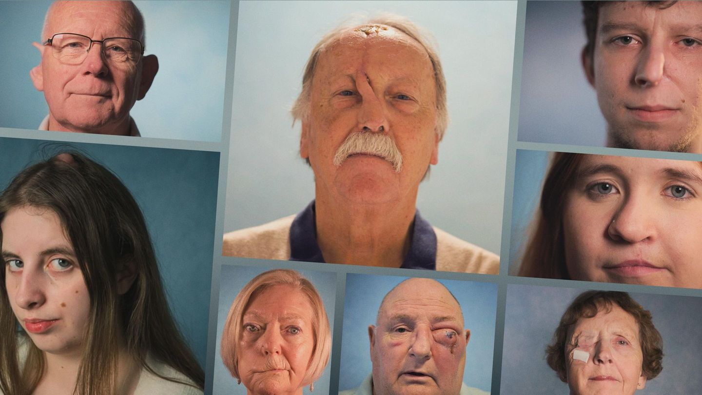 Chirurgie du visage : un nouvel espoir