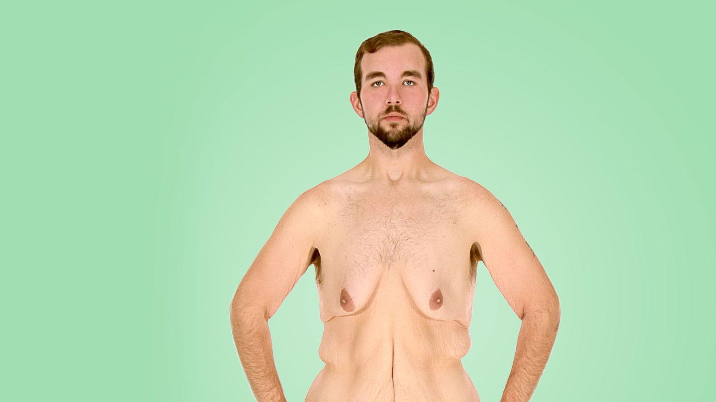 New Skin : chirurgie de l’extrême