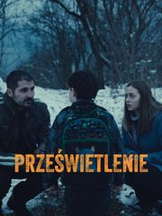 Prześwietlenie