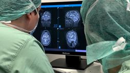 Soigner Parkinson, l'épilepsie, la dépression : La stimulation cérébrale, un nouvel espoir