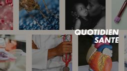 Arythmies cardiaques