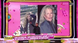 Kim Basinger méconnaissable après avoir eu recours à la chirurgie esthétique !
