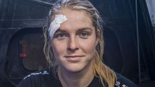Episode 2