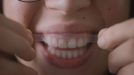 Des dents blanches... au rire jaune !
