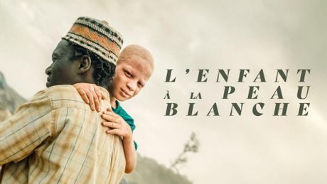 L'enfant à la peau blanche